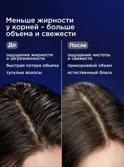 Шампунь для жирной кожи головы