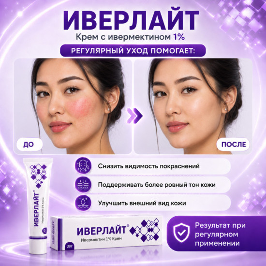 Крем от покраснений и высыпаний при розацеа с ивермектином 1% Иверлайт, 30 г