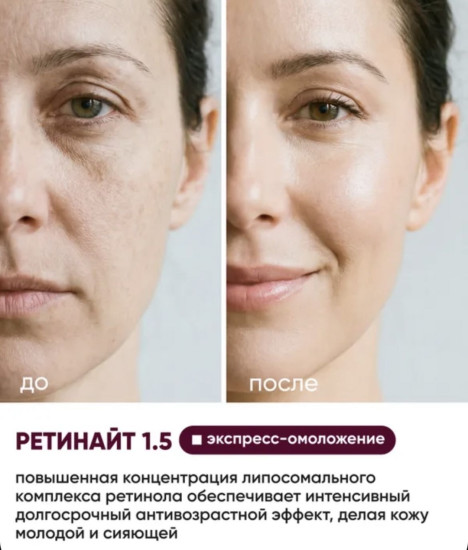 Крем для лица антивозрастной с ретинолом 1.5% «Ретинайт»