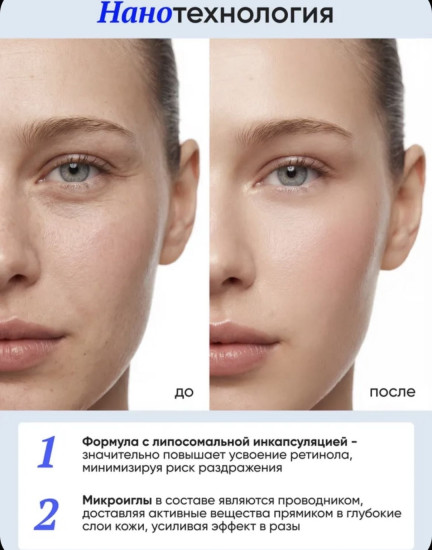 Крем для век c ретинолом «Retinol boost»