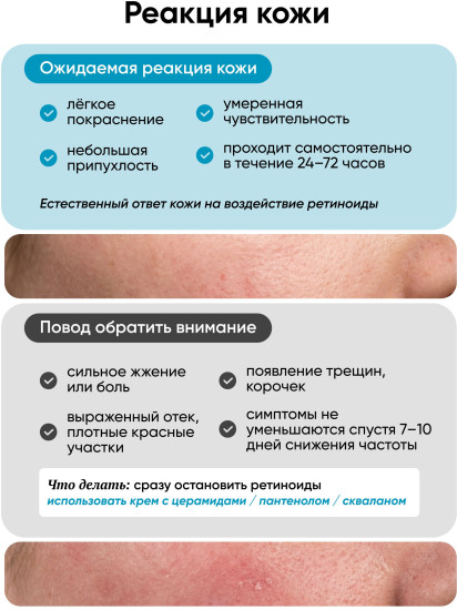Сыворотка для лица с ретинолом