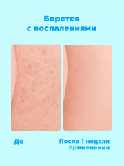 Гель-эликсир для душа «Soft skin» - Фото 3