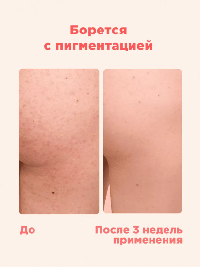 Скраб для тела «Ягодная роскошь»