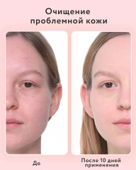 Пенка для умывания с ниацинамидом, цинком и салициловой кислотой - Фото 3