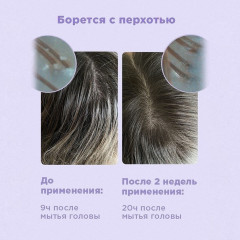 Шампунь для чувствительной кожи головы «Delicate» - Фото 3