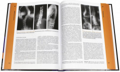 Ортопедия и травматология по Эпли. Общая ортопедия. В 3 томах. Том 2. Частная ортопедия - Фото 1