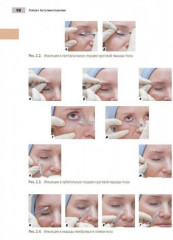 Азбука ботулинотерапии. Научно-практическое издание - Фото 4