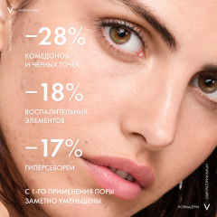 Набор «Очищение и защита для кожи, склонной к несовершенствам» - Фото 4