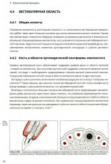 Имплантация в эстетически значимой зоне. Поэтапный алгоритм планирования лечения - Фото 4