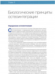 Имплантаты под наклоном. Протезирование с опорой на имплантаты при выраженной атрофии челюстей - Фото 1