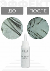 Набор для пилинга кожи головы «Scalp Care» - Фото 4