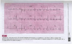 Атлас ЭКГ. 150 клинических ситуаций - Фото 1