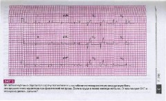 Атлас ЭКГ. 150 клинических ситуаций - Фото 3