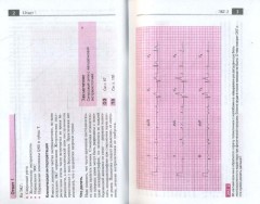 Атлас ЭКГ. 150 клинических ситуаций - Фото 5