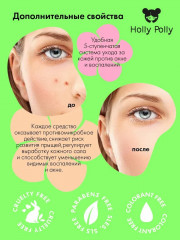 Сыворотка точечная SOS-помощь против акне для проблемной кожи лица «Bye Bye Acne!» - Фото 3