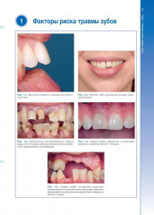 Травмы зубов. Наглядное пособие - Фото 3