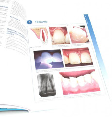 Травмы зубов. Наглядное пособие - Фото 5