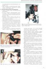 Заболевания глазного дна - Фото 6