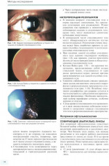 Заболевания глазного дна - Фото 7