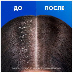 Шампунь и бальзам-ополаскиватель против перхоти «Комплексный уход» - Фото 8