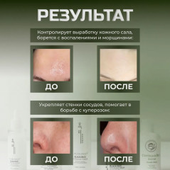 Сыворотка для проблемной кожи лица «Intensive Serum» - Фото 4