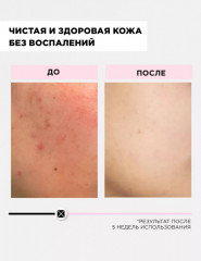 Энзимная пудра очищающая от прыщей и пигментации - Фото 3