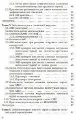 Электрофизиологический мониторинг центральной нервной системы - Фото 2