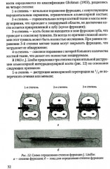 Диагностика пародонтита - Фото 2
