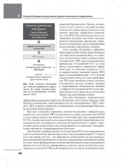 Лечение бесплодия при эндометриозе. Взгляд репродуктолога - Фото 11