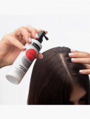 Лосьон против выпадения волос «Tonifying аnd Prevention Control Hair Loss Lotion» - Фото 2