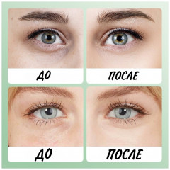 Патчи для глаз с алоэ вера - Фото 3