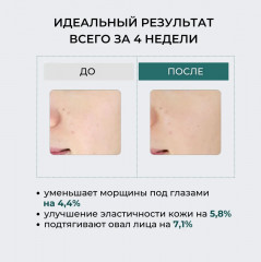 Крем-лифтинг для кожи лица «Nano N.D 1200 Lifting Cream» - Фото 7