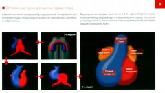Атлас по УЗД в акушерстве. Нормальная ультразвуковая топографическая анатомия сердца плода - Фото 4