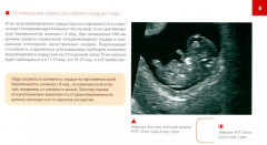 Атлас по УЗД в акушерстве. Нормальная ультразвуковая топографическая анатомия сердца плода - Фото 6