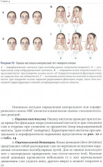 Ишемический инсульт: диагностика, лечение, реабилитация и профилактика. Руководство для врачей - Фото 10