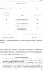 Ишемический инсульт: диагностика, лечение, реабилитация и профилактика. Руководство для врачей - Фото 11