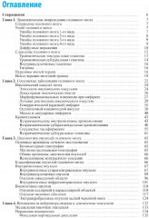 Лучевая диагностика заболеваний головного мозга - Фото 2