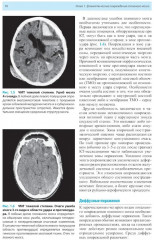 Лучевая диагностика заболеваний головного мозга - Фото 7