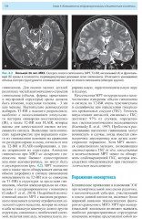 Лучевая диагностика заболеваний головного мозга - Фото 12