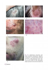 Первичные рубцовые алопеции. Диагностика и лечение. Иллюстрированное руководство для врачей - Фото 7