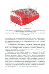 Диагностика, лечение и профилактика основных заболеваний и болевых синдромов языка - Фото 6