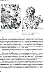 Иллюзии, галлюцинации и бредовые расстройства - Фото 7