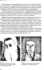 Иллюзии, галлюцинации и бредовые расстройства - Фото 9