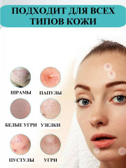 Набор патчей противовоспалительные от прыщей - Фото 1