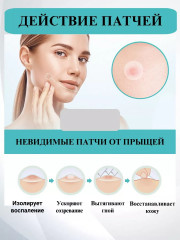 Набор патчей противовоспалительные от прыщей - Фото 3