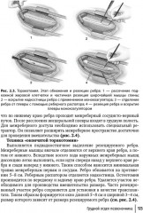 Техника и принципы хирургического лечения заболеваний и повреждений позвоночника - Фото 13