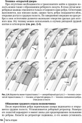 Техника и принципы хирургического лечения заболеваний и повреждений позвоночника - Фото 14