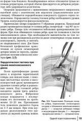 Техника и принципы хирургического лечения заболеваний и повреждений позвоночника - Фото 15