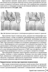Техника и принципы хирургического лечения заболеваний и повреждений позвоночника - Фото 17