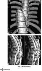 Техника и принципы хирургического лечения заболеваний и повреждений позвоночника - Фото 20